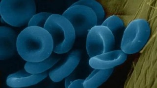 El extraño caso de una mujer cuya sangre se le volvió azul por un anestésico dental. El extraño caso de una mujer cuya sangre se le volvió azul por un anestésico dental.