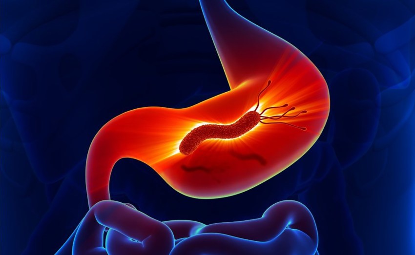 Conoce a Helicobacter pylori, una bacteria peligrosa
