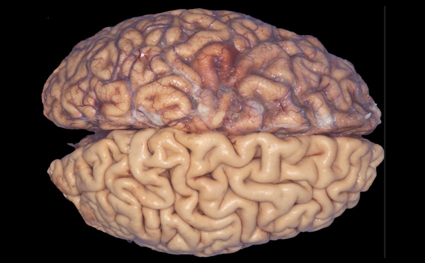 El cerebro humano es capaz de generar nuevas neuronas hasta los 90 años.