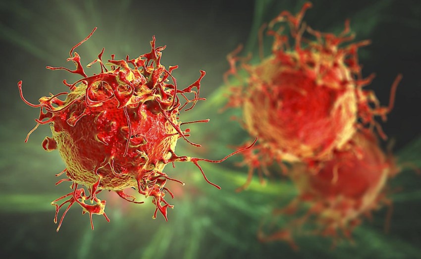 Qué es el cáncer, cómo se origina y cuáles son sus causas.