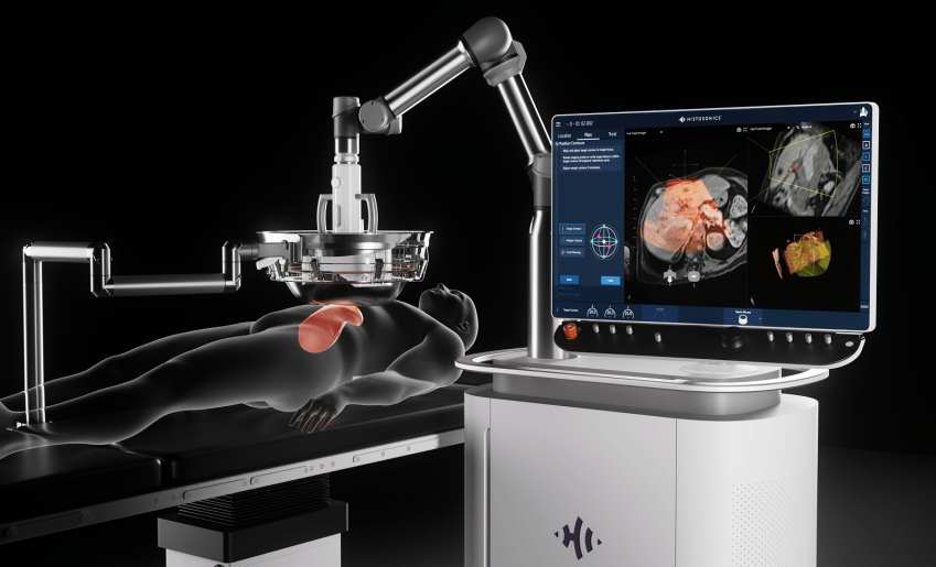 Ondas de ultrasonido, la alternativa revolucionaria para eliminar tumores cancerosos de manera selectiva.
