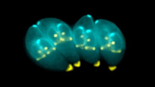 Identifican un parásito cerebral que puede alterar la comunicación neuronal. Identifican un parásito cerebral que puede alterar la comunicación neuronal.