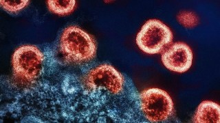 Logran hacer visible el VIH oculto en las células: un paso clave hacia la cura definitiva. Logran hacer visible el VIH oculto en el cuerpo humano