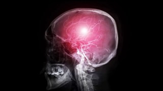 Un simple masaje facial podría ayudar a limpiar tu cerebro al estimular el drenaje linfático. Un simple masaje facial podría ayudar a limpiar tu cerebro al estimular el drenaje linfático.