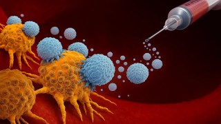 Células entrenadas para matar el cáncer: así funciona la inmunoterapia personalizada. Células entrenadas para matar el cáncer: así funciona la nueva inmunoterapia personalizada