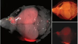 Implantan neuronas humanas en el cerebro de ratas y logran restaurar funciones sensoriales perdidas. Implantan neuronas humanas en el cerebro de ratas y logran restaurar funciones sensoriales perdidas.