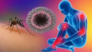 La OMS advierte que el nuevo brote de chikungunya podría convertirse en una amenaza global. La OMS advierte que el nuevo brote de chikungunya podría convertirse en una amenaza global.