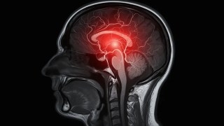 Tu forma de hablar podría revelar los primeros signos del deterioro cognitivo. Tu forma de hablar podría revelar los primeros signos del deterioro cognitivo.