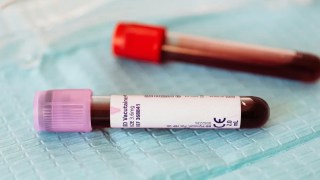 Científicos descubren cómo la sangre joven puede revertir el envejecimiento celular en la piel humana. Científicos descubren cómo la sangre joven puede revertir el envejecimiento celular en la piel humana.
