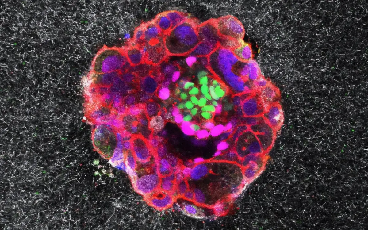 Científicos registran por primera vez en tiempo real la implantación ...