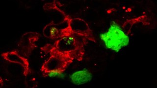 Crean una vacuna "universal" contra el cáncer que destruye los tumores más resistentes en ensayos preclínicos. Crean una vacuna "universal" contra el cáncer que destruye los tumores más resistentes en ensayos preclínicos.
