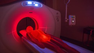 El riesgo oculto de las tomografías computarizadas: su uso frecuente puede causar cáncer. El riesgo oculto de las tomografías computarizadas: su uso frecuente puede causar cáncer.