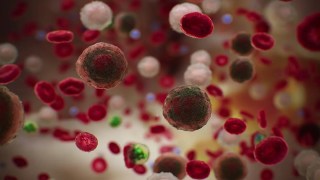 La vacuna ELI-002 contra el cáncer de colon y páncreas muestra eficacia en ensayos clínicos iniciales. La vacuna ELI-002 contra el cáncer de colon y páncreas muestra eficacia en ensayos clínicos iniciales.