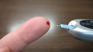 Científicos implantan células madre pancreáticas en el brazo de un paciente… y logran producir insulina. Científicos implantan células madre pancreáticas en el brazo de un paciente… y logran producir insulina.
