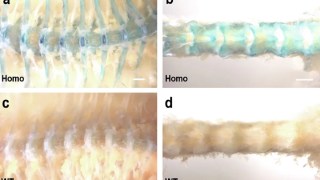 Nuevo hallazgo: descubren una proteína que ayuda a formar huesos más fuertes y podría tratar la osteoporosis. descubren una proteína que ayuda a formar huesos más fuertes