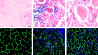 Científicos descubren una proteína que propaga el envejecimiento en todo el cuerpo. proteína que propaga el envejecimiento.