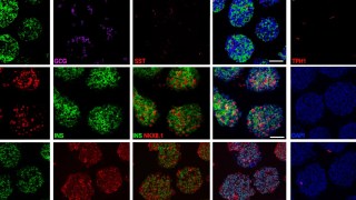 CientÃficos chinos logran revertir la diabetes tipo 1 y tipo 2 en humanos usando células madre. CientÃficos chinos logran revertir la diabetes tipo 1 y tipo 2 en humanos usando células madre.