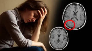 CientÃficos descubren cómo el cerebro transforma el dolor en miedo, trauma y sufrimiento duradero. CientÃficos descubren cómo el cerebro transforma el dolor en miedo, trauma y sufrimiento duradero.