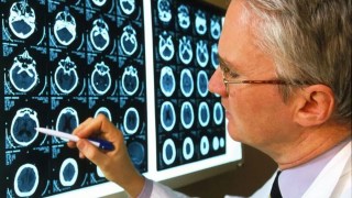 Científicos descubren que la falta de litio en el cerebro podría ser la causa temprana del Alzheimer. Científicos descubren que la falta de litio en el cerebro podría ser la causa temprana del Alzheimer.