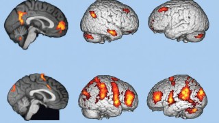 Descubren el origen de la conciencia en lo más profundo del cerebro, donde nadie imaginaba. Descubren el origen de la conciencia en lo más profundo del cerebro, donde nadie imaginaba.