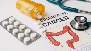 Un medicamento común y económico logra reducir la recurrencia del cáncer colorrectal.