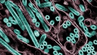 Científicos advierten que el virus de la gripe aviar puede sobrevivir durante meses en leche y queso sin pasteurizar. Científicos advierten que el virus de la gripe aviar puede sobrevivir durante meses en leche y queso sin pasteurizar.