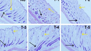 Científicos descubren una molécula natural capaz de estimular el crecimiento del cabello igual que el minoxidil. Científicos descubren una molécula natural capaz de estimular el crecimiento del cabello igual que el minoxidil.