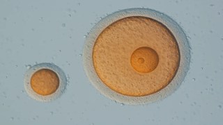 Científicos logran crear óvulos a partir de células de la piel humana. Científicos logran crear óvulos a partir de células de la piel humana