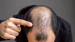 CientĆficos logran estimular el crecimiento del cabello en solo 56 dĆas con una fórmula a base de plantas. CientĆficos logran estimular el crecimiento del cabello en solo 56 dĆas con una fórmula a base de plantas.