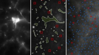 Científicos visualizan por primera vez grupos de proteínas vinculados al Parkinson en el cerebro humano. Científicos visualizan por primera vez grupos de proteínas vinculados al Parkinson en el cerebro humano.