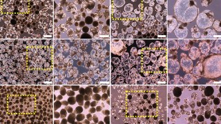 Crean riñones sintéticos y funcionales en laboratorio: un logro que podría transformar la medicina regenerativa. Crean riñones sintéticos y funcionales en laboratorio un logro que podría transformar la medicina regenerativa.