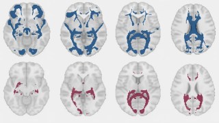 La ciencia revela que el cerebro femenino cambia su estructura en cada ciclo menstrual. La ciencia revela que el cerebro femenino cambia su estructura en cada ciclo menstrual.