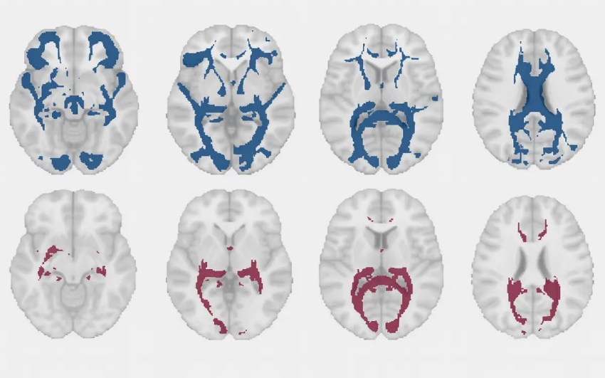 La ciencia revela que el cerebro femenino cambia su estructura en cada ciclo menstrual.