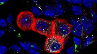 Los casos de cáncer se disparan en la generación millennial: la ciencia revela las causas detrás del aumento. Los casos de cáncer se disparan en la generación millennial