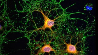 Identifican una proteína clave del cerebro que podría frenar el deterioro cognitivo y el envejecimiento neuronal. Identifican una proteína clave del cerebro que podría frenar el deterioro cognitivo