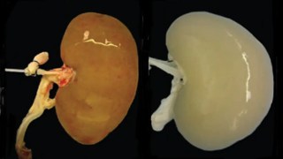 CientÃficos crean el primer riñón funcional en laboratorio, capaz de producir orina después de un trasplante. CientÃficos crean el primer riñón funcional en laboratorio, capaz de producir orina después de un trasplante.