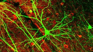 Descubren que el cerebro tiene un mecanismo oculto para eliminar las placas del Alzheimer. Descubren que el cerebro tiene un mecanismo oculto para eliminar las placas del Alzheimer.