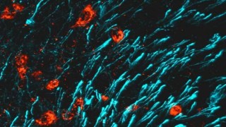 Descubren un mecanismo clave para fortalecer los huesos y revertir la osteoporosis. Descubren un mecanismo clave para fortalecer los huesos y revertir la osteoporosis.