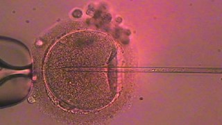Un donante de esperma transmitió un gen cancerígeno a casi 200 niños en 14 países: algunos ya murieron por cáncer. Un donante de esperma transmitió un gen cancerígeno a casi 200 niños en 14 países