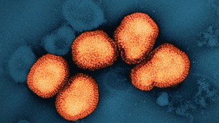 Alerta en Reino Unido: la nueva variante de gripe H3N2 está disparando las hospitalizaciones. la nueva variante de gripe H3N2 está disparando las hospitalizaciones.