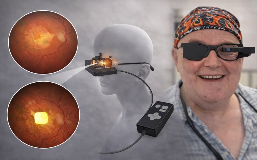 Un implante en la retina devuelve visión central a 38 personas con ceguera avanzada.