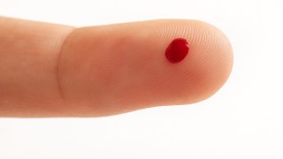 La ciencia crea un test mínimamente invasivo para detectar Alzheimer con una simple gota de sangre. Una gota de sangre prueba simple que podría agilizar el diagnóstico de Alzheimer