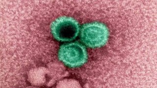 Científicos crean un anticuerpo capaz de bloquear uno de los virus más comunes del mundo. Científicos crean un anticuerpo capaz de bloquear uno de los virus más comunes del mundo.
