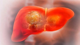 Descubren que los compuestos del cannabis pueden mejorar el metabolismo y revertir el hĂgado graso. Descubren que los compuestos del cannabis pueden mejorar el metabolismo y revertir el hĂgado graso.