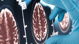 Estudios científicos sugieren que la Viagra podría convertirse en una de las mejores opciones contra el Alzheimer. Estudios científicos sugieren que la Viagra podría convertirse en una de las mejores opciones contra el Alzheimer.
