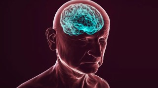 Los 4 tipos de demencia más raros... que la mayoría de la gente desconoce. Los 4 tipos de demencia más raros... que la mayoría de la gente desconoce.
