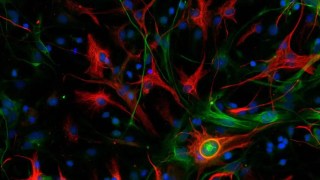 ¿Por qué estamos perdiendo la batalla contra el cáncer? La ciencia acaba de revelar algo inquietante. Por qué estamos perdiendo la batalla contra el cáncer