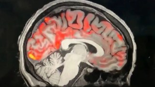 Tu forma de hablar podría revelar señales tempranas del deterioro cognitivo. Tu forma de hablar podría revelar señales tempranas del deterioro cognitivo.