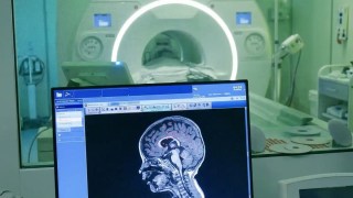 Descubren el error genético que causa uno de los trastornos cerebrales más comunes en los niños. Descubren el error genético que causa uno de los trastornos cerebrales más comunes en los niños.