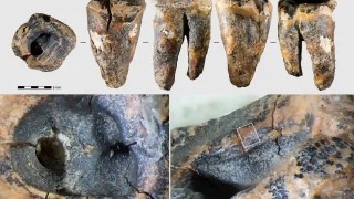 Descubren que los neandertales ya realizaban curaciones dentales hace 59 mil años usando herramientas de piedra. los neandertales ya realizaban curaciones dentales hace 59 mil años usando herramientas de piedra.